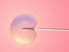 甘肃地区有哪些私立的机构可以做试管技术？2026兰大一院试管医生名单揭晓