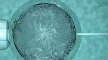 试管婴儿的拮糖技方案（试管婴儿拮抗剂药物有哪些）